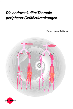 Die endovaskuläre Therapie peripherer Gefäßerkrankungen von Teßarek,  Jörg