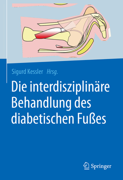 Die interdisziplinäre Behandlung des diabetischen Fußes von Kessler,  Sigurd