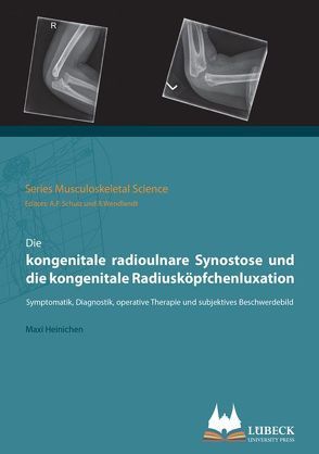 Die kongenitale radioulnare Synostose und die kongenitale Radiusköpfchenluxation von Heinichen,  Maxi