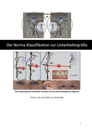 Die Norma Klassifikation zur Unterkiefergröße von Martin,  vom Brocke