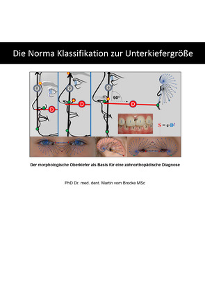 Die Norma Klassifikation zur Unterkiefergröße von Martin,  vom Brocke