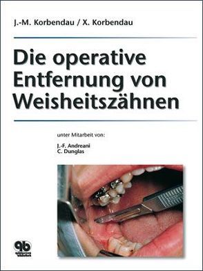 Die operative Entfernung von Weisheitszähnen von Hermann,  Joachim S, Korbendau,  Jean Marie, Korbendau,  Xavier