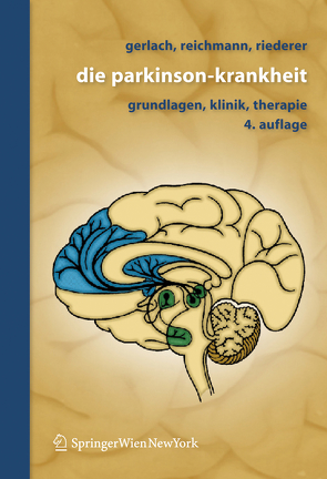 Die Parkinson-Krankheit von Dietmaier,  Otto, Gerlach,  Manfred, Götz,  Wolfgang, Laux,  Gerd, Reichmann,  Heinz, Riederer,  Peter, Storch,  Alexander