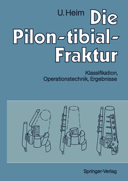 Die Pilon-tibial-Fraktur von Allgöwer,  M., Gächter,  A., Hefti,  F., Heim,  Urs, Müller,  M.E., Müller-Gerbl,  M., Putz,  R., Rüedi,  T.