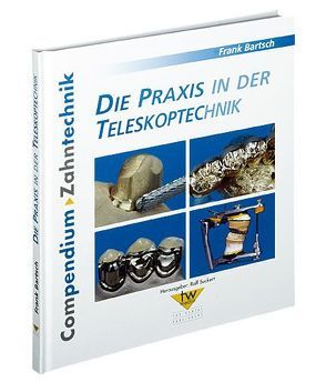 Die Praxis in der Teleskoptechnik von Bartsch,  Frank, Suckert,  Ralf