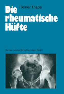 Die rheumatische Hüfte von Thabe,  Heiner