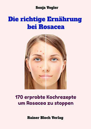 Die richtige Ernährung bei Rosacea von Vogler,  Sonja