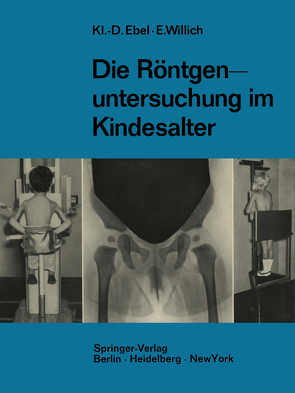 Die Röntgenuntersuchung im Kindesalter von Ebel,  Klaus-Dietrich, Willich,  Eberhard