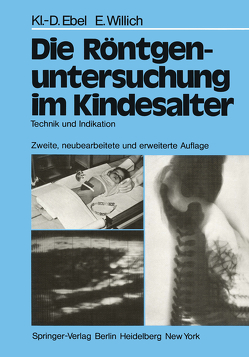 Die Röntgenuntersuchung im Kindesalter von Ebel,  Klaus-D., Schall,  Lutz, Schulz,  R.D., Willich,  Eberhard