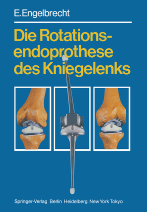 Die Rotationsendoprothese des Kniegelenks von Buchholz,  H. W., Engelbrecht,  E.