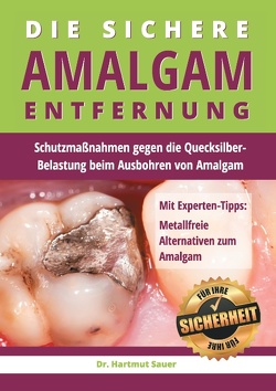 Die sichere Amalgam-Entfernung von Sauer,  Hartmut