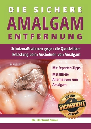 Die sichere Amalgam-Entfernung von Sauer,  Hartmut