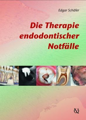 Die Therapie endodontischer Notfälle von Schäfer,  Edgar