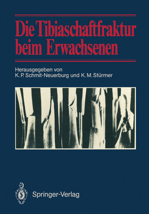 Die Tibiaschaftfraktur beim Erwachsenen von Schmit-Neuerburg,  K.P., Stürmer,  K.-M.