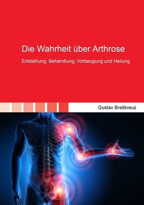 Die Wahrheit über Arthrose von Breitkreuz,  Gustav