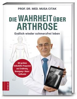 Die Wahrheit über Arthrose von Citak,  Musa