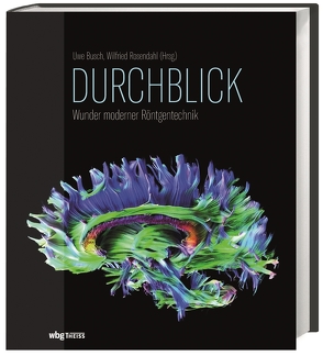 Die Welt im Durchblick von Busch,  Uwe, Rosendahl,  Wilfried