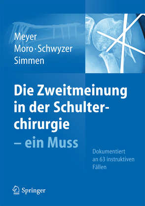 Die Zweitmeinung in der Schulterchirurgie – ein Muss von Meyer,  Rainer-Peter, Moro,  Fabrizio, Schwyzer,  Hans-Kaspar, Simmen,  Beat