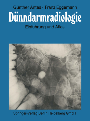 Dünndarmradiologie von Antes,  Günther, Eggemann,  Franz, Lissner,  Josef