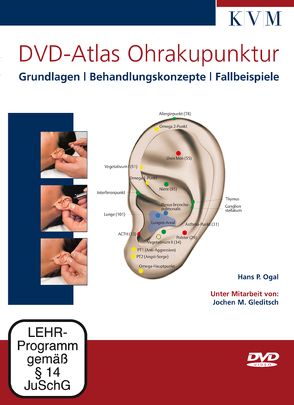 DVD-Atlas Ohrakupunktur von Ogal,  Hans P