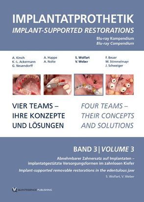 DVD-Kompendium Implantatprothetik Band 3 von Weber,  Volker, Wolfart,  Stefan