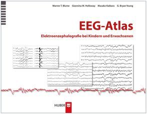 EEG–Atlas von Blume,  Warren T., Holloway,  Giannina M., Kaibara,  Masako, Tönjes,  Sibylle, Young,  G. Bryan