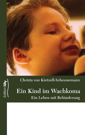 Ein Kind im Wachkoma von Kietzell-Scheunemann,  Christa von