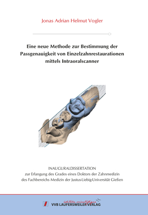 Eine neue Methode zur Bestimmung der Passgenauigkeit von Einzelzahnrestaura-tionen mittels Intraoralscanner von Vogler,  Jonas