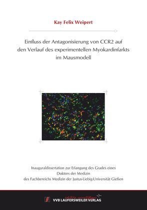 Einfluss der Antagonisierung von CCR2 auf den Verlauf des experimentellen Myokardinfarkts im Mausmodell von Weipert,  Kay Felix