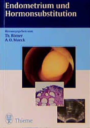 Endometrium und Hormonsubstitution von Mück,  Alfred O., Römer,  Thomas