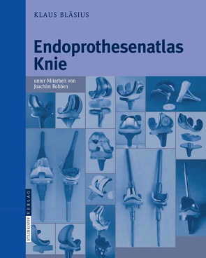 Endoprothesenatlas Knie von Bläsius,  Klaus, Robben,  Joachim