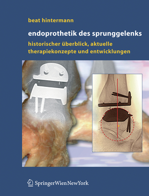 Endoprothetik des Sprunggelenks von Hintermann,  Beat