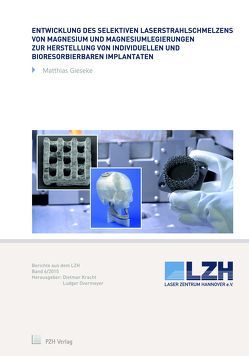 Entwicklung des selektiven Laserstrahlschmelzens von Magnesium und Magnesiumlegierungen zur Herstellung von individuellen und bioresorbierbaren Implantaten von Gieseke,  Matthias, Kracht,  Dietmar, Overmeyer,  Ludger