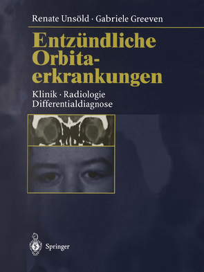 Entzündliche Orbitaerkrankungen von Greeven,  Gabriele, Unsöld,  Renate