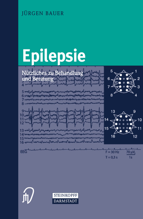 Epilepsie von Bauer,  Jürgen