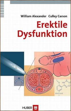 Erektile Dysfunktion von Alexander,  William, Carson,  Culley, Herrmann,  Michael