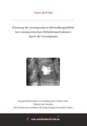 Erfassung der postoperativen Behandlungseffekte bei osteoporotischen Wirbelkörperfrakturen durch die Vesselplastie von Rotter,  Anja