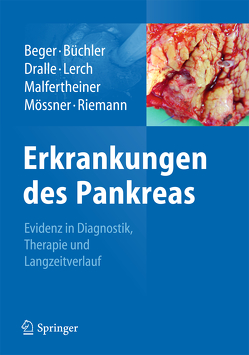 Erkrankungen des Pankreas von Beger,  Hans G., Büchler,  Markus W., Dralle,  Henning, Lerch,  Markus M., Malfertheiner,  Peter, Mössner,  Joachim, Riemann,  Jürgen F