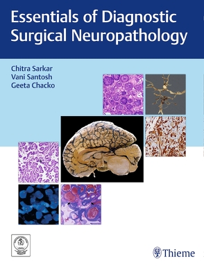 Essentials of Diagnostic Surgical Neuropathology von Chacko,  Geeta, Mahadevan,  Anita, Santosh,  Vani, Sarkar,  Chitra