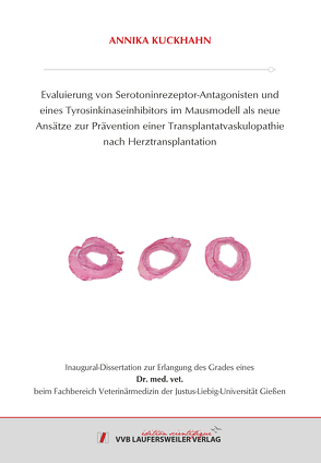 Evaluierung von Serotoninrezeptor-Antagonisten und eines Tyrosinkinaseinhibitors im Mausmodell als neue Ansätze zur Prävention einer Transplantatvaskulopathie nach Herztransplantation von Kuckhahn,  Annika