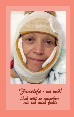 Facelift – na und? von Fischer,  Ute, Siegmund,  Bernhard