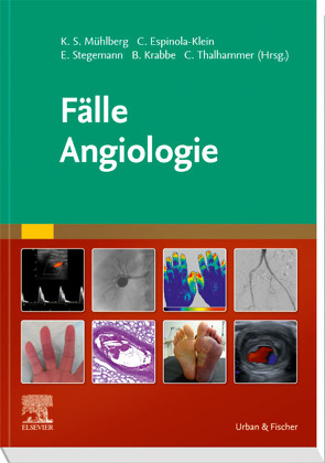 Fälle Angiologie von Espinola-Klein,  Christine, Krabbe,  Bernd, Mühlberg,  Katja S., Stegemann,  Emilia, Thalhammer,  Christoph