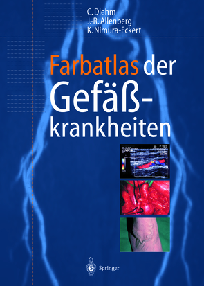 Farbatlas der Gefäßkrankheiten von Allenberg,  J.-R., Diehm,  Curt, Nimura-Eckert,  Keiko