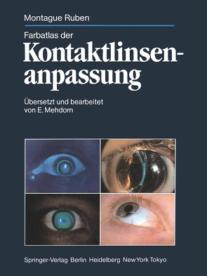 Farbatlas der Kontaktlinsenanpassung von Mehdorn,  E., Ruben,  Montague