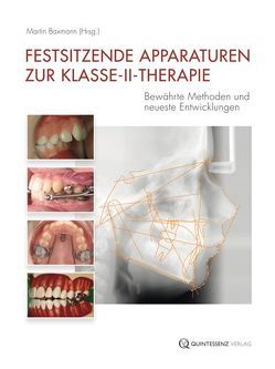 Festsitzende Apparaturen zur Klasse-II-Therapie von Baxmann,  Martin