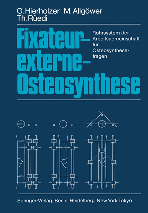 Fixateur-externe-Osteosynthese von Allgöwer,  M., Hierholzer,  G., Rüedi,  T.