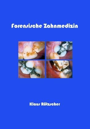 Forensische Zahnmedizin von Rötzscher,  Klaus