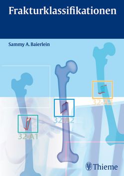 Frakturklassifikationen von Baierlein,  Sammy Alexander, Finkenzeller,  Gerhard, Rikli,  Daniel, Schmidt,  Frank, Skarvan,  Jiri