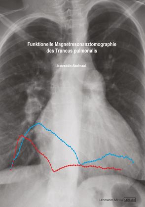 Funktionelle Magnetresonanztomographie des Truncus pulmonalis von Abolmaali,  Nasreddin