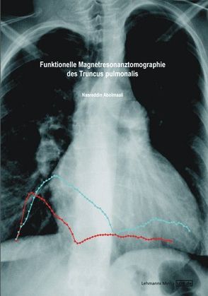 Funktionelle Magnetresonanztomographie des Truncus pulmonalis von Abolmaali,  Nasreddin